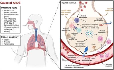 Hypoxia-adenosine axis as therapeutic targets for acute respiratory distress syndrome